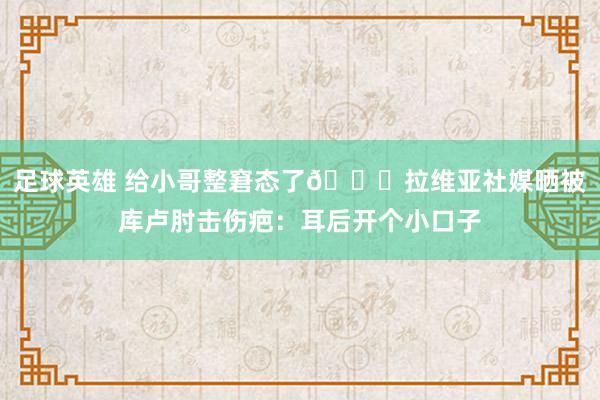 足球英雄 给小哥整窘态了😅拉维亚社媒晒被库卢肘击伤疤：耳后开个小口子